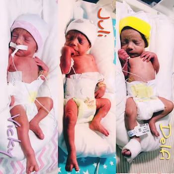 Nacieron trigemelas: un caso extremadamente raro que ocurre en uno de cada 200 millones de&nbsp;nacimientos